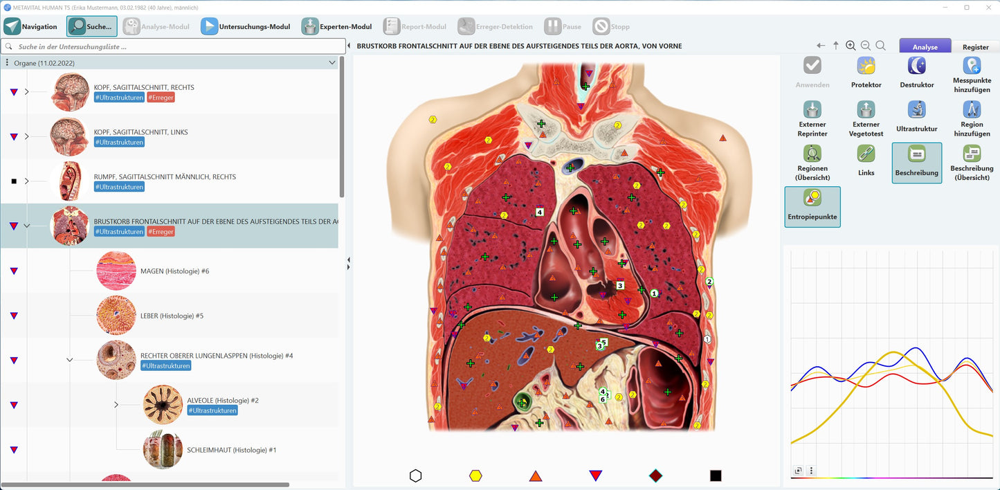 METAVITAL-Expert / E-smog-Analyse